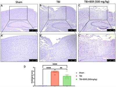 Autophagy machinery plays an essential role in traumatic brain injury-induced apoptosis and its related behavioral abnormalities in mice: focus on Boswellia Sacra gum resin